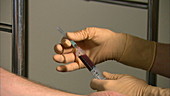 Doctor holding syringe with blood