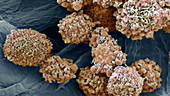 Breast cancer cells, SEM