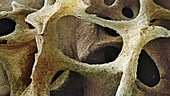 Bone tissue, SEM