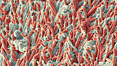 Dental plaque, SEM