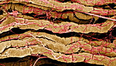 Coloured SEM of nerve fibres