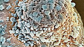 Colon cancer cell, SEM
