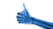 X-ray thumbs up in slow motion