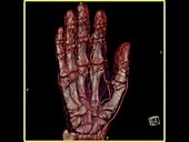 Rotating scan of a hand