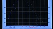 Tracking weather balloon, Antarctica