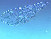 Blepharisma ciliate protozoa