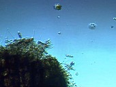 Euplotes ciliate protozoa