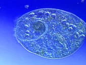 Stentor coeruleus ciliate protozoa