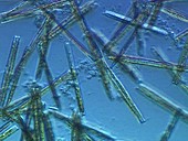 Diatom cells