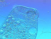 Stentor coeruleus ciliate protozoa