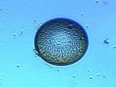 Didinium nasutum protozoa cyst