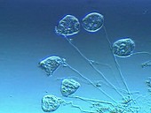 Vorticella ciliate protozoa