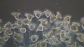 Vorticella protozoa