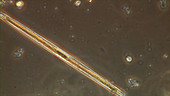 Pennate diatoms