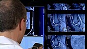 Doctor with medical scans