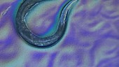 C elegans worms, light microscopy