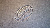 C elegans embryo, light microscopy