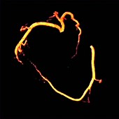 Coronary arteries, 4D MRA scan