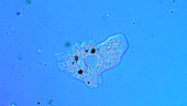 Amoeba protozoan
