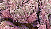 Kidney glomeruli, SEM