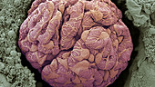 Kidney glomerulus, SEM