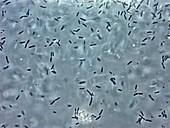 Bacteria from chicken