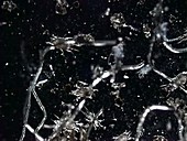 Dermatophagoides farinae, dust mite