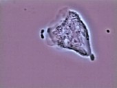 Capsule of Streptococcus pneumoniae