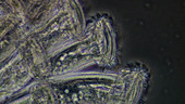 Epistylis ciliate protozoa