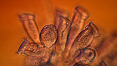 Epistylis ciliate protozoa