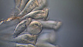 Epistylis ciliate protozoa