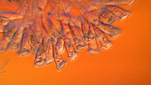 Epistylis ciliate protozoa