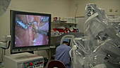 Robotic prostate cancer surgery