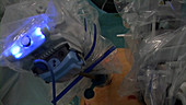 Robotic prostate cancer surgery