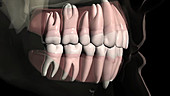 Normal dental occlusion