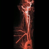 Arteries, MRA scan sequence