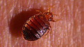 Bedbug dorsal view