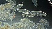 Paramecium swimming in pond water