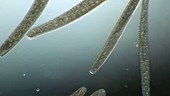 Spirostomum swimming in pond water