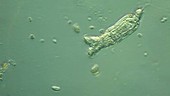 Rotifers feeding in pond water