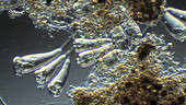 Vorticella colony in wastewater