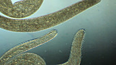 Spirostomum swimming in pond water