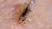 Head louse feeding on human