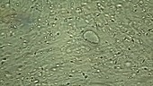 Human sperm under microscope