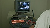 Foetal ultrasound