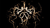 Brain arteries, 3D MRA scan