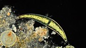 Closterium desmid, light microscopy