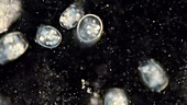 Free-swimming vorticella protozoa