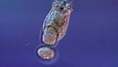 Rotifer swimming with eggs