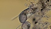 Keratella valga rotifer carrying eggs
